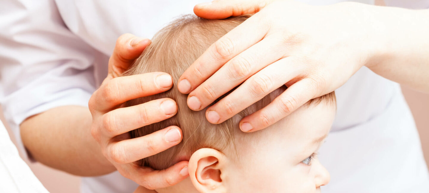 plagiocephalie bébé tête plate