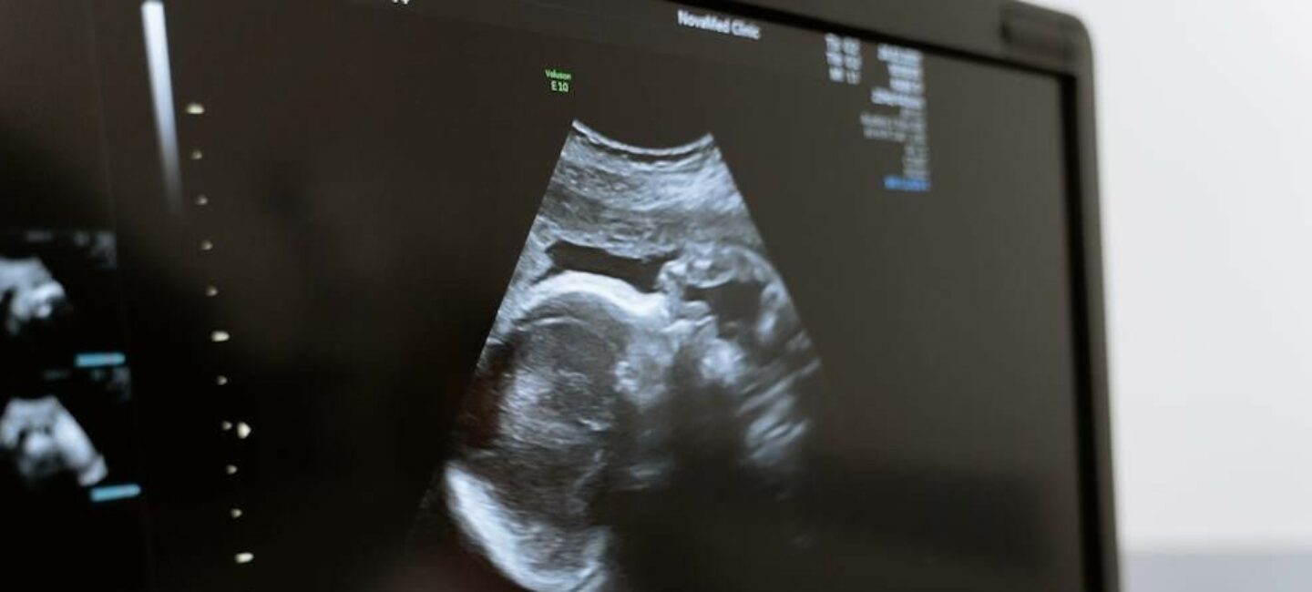 développement fœtus